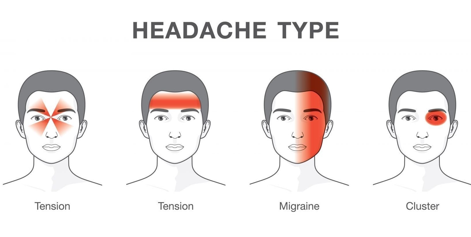 Почему болит голова во время поста. Типы головной боли. Болит голова. Типы и симптомы головных болей. Типы головной боли по зонам.